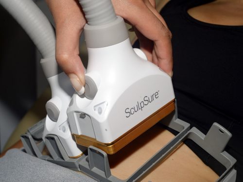 Sculpsure-Vs-Coolsculpting-Which-Is-The-Best-Body-Sculpting-Technique.jpg